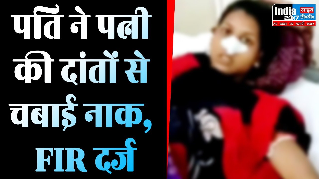 Bareilly Crime: पति ने दहेज की मांग को लेकर पत्नी की नाक चबाकर जख्मी कर दी, FIR दर्ज