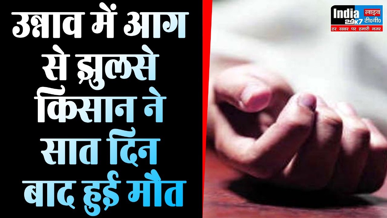 Unnao News : उन्नाव में जमीनी विवाद में झुलसे किसान की मौत, दो आरोपी गिरफ्तार