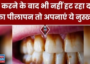 Teeth Whitening: ब्रश करने के बाद भी नहीं हट रहा दांतों का पीलापन? ये नुस्खा अपनाएं और चमकाएं अपने दांत
